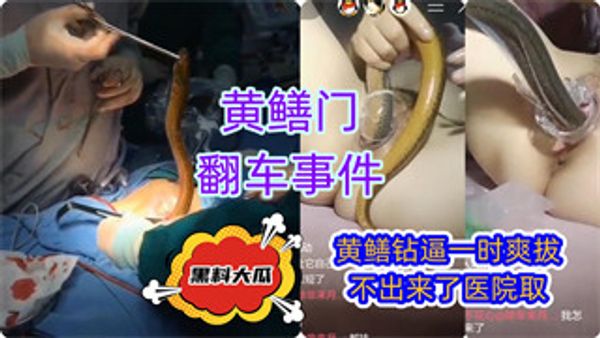 黄鳝门翻车事件直播黄鳝插逼医院取